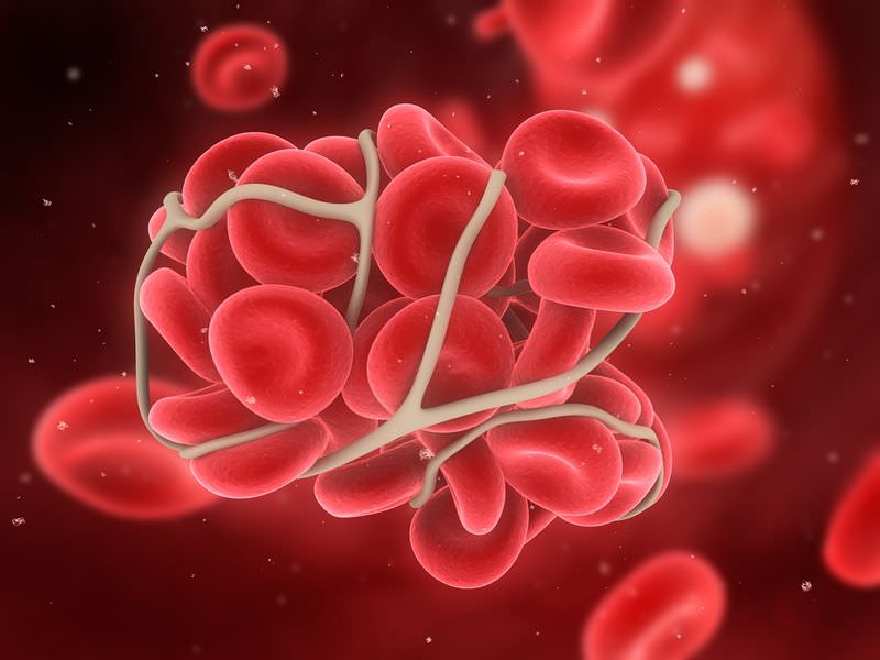 Hemolytic anemias